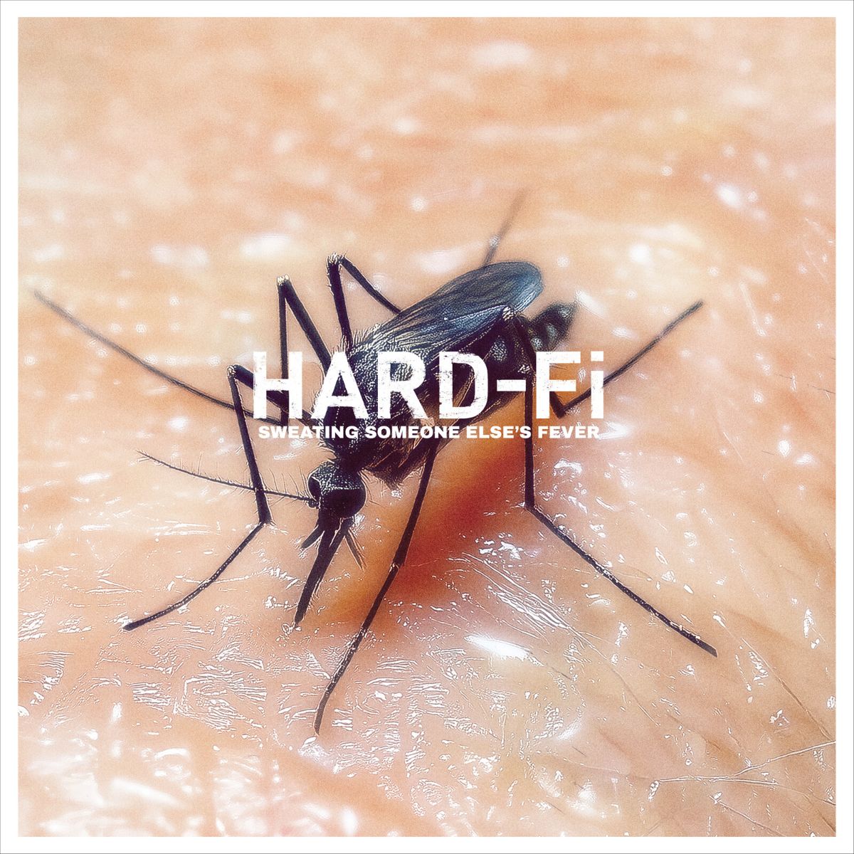 Hard-Fi - Sweating Someone Else’s Fever - Exclusive Turquoise VINYL